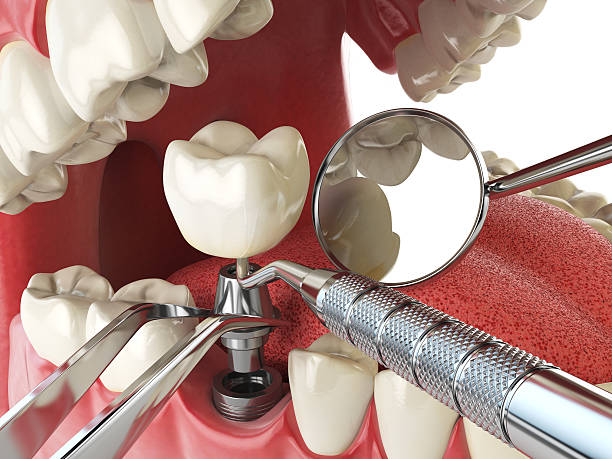 Best Holiday Emergency Dentist in Glendale, MO